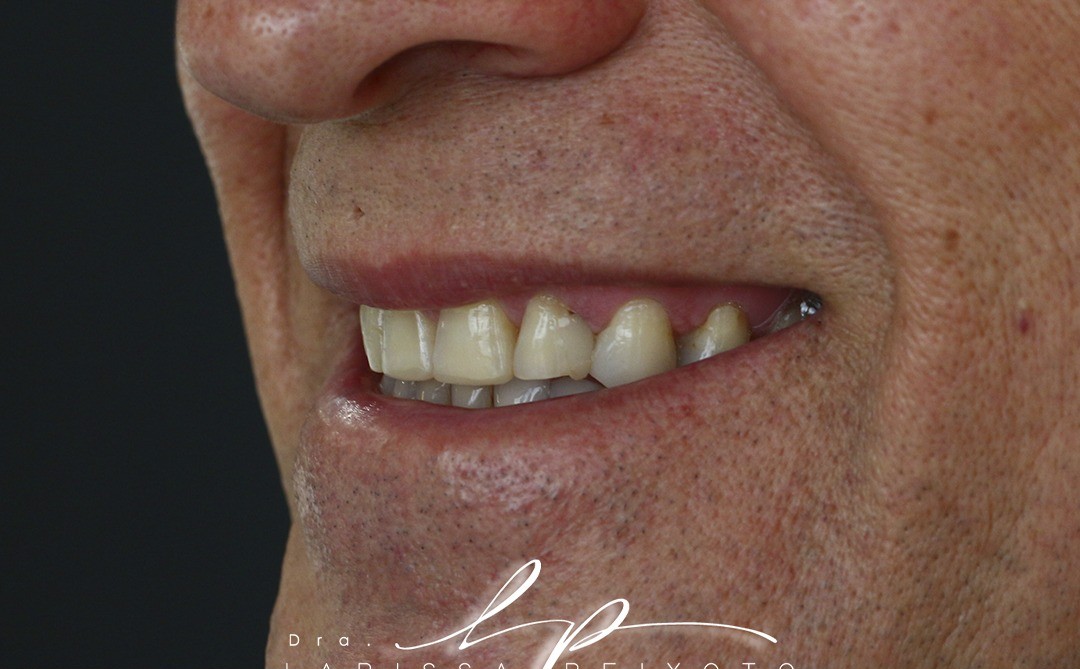 Before treatment