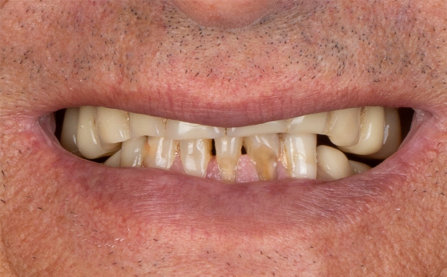 Before treatment